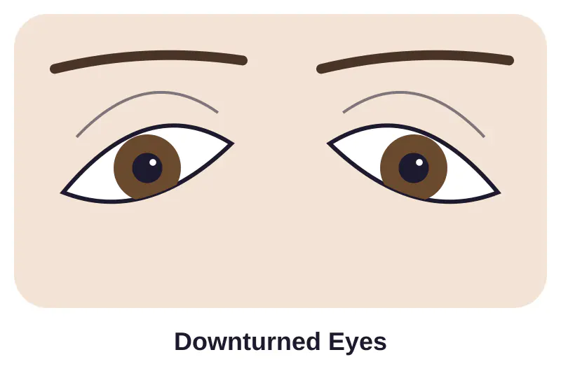 Illustration of downturned eyes