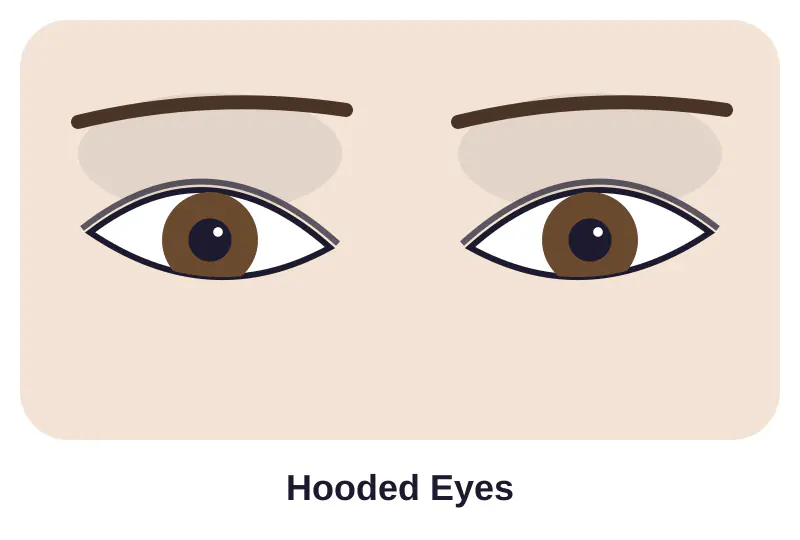 Illustration of hooded eyes