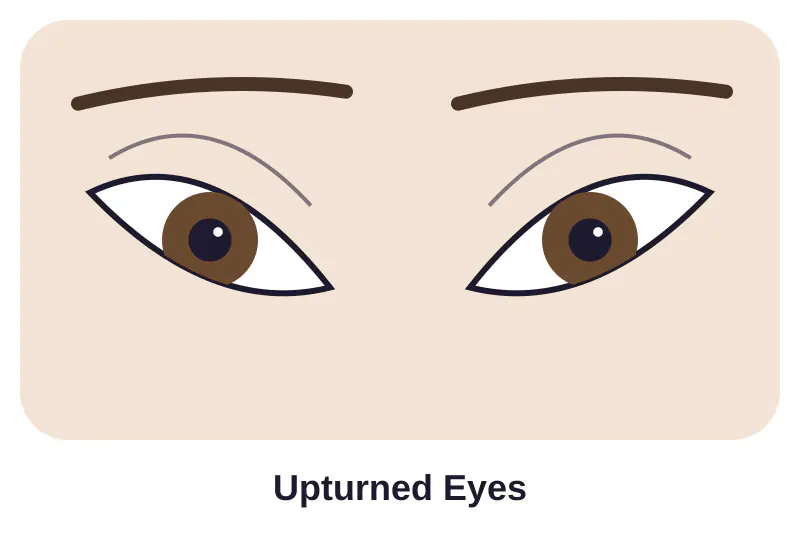Illustration of upturned eyes