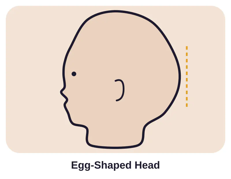 Illustration of egg-shaped head