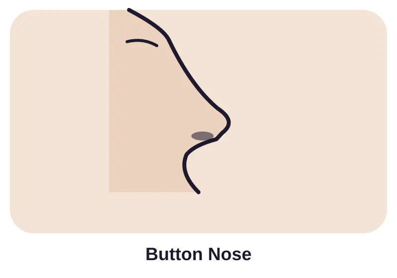 Illustration of button nose