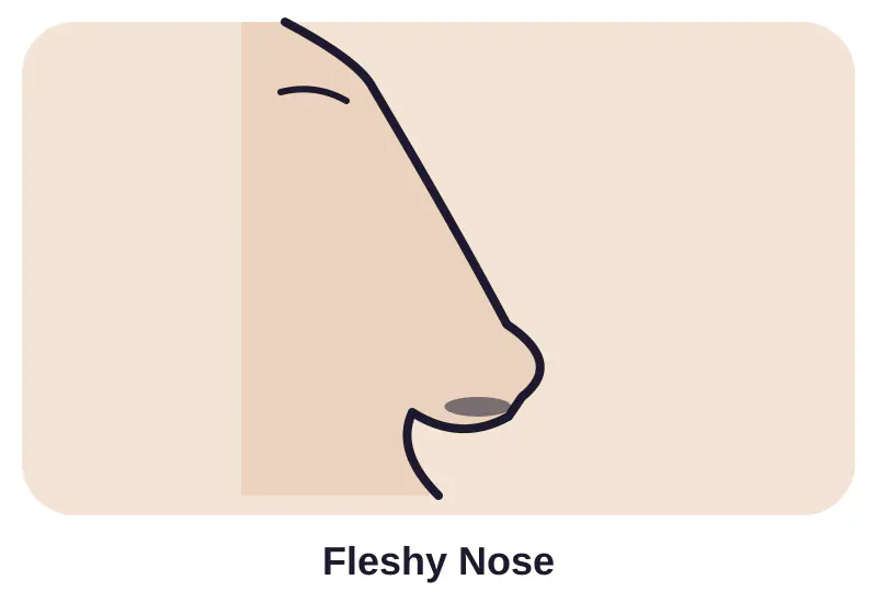 Illustration of fleshy nose