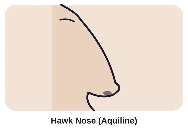Illustration of hawk nose (aquiline)