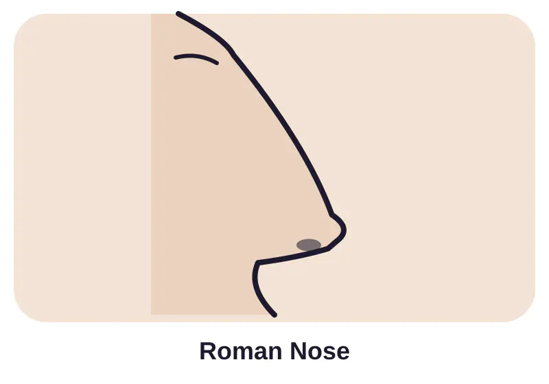 Illustration of roman nose