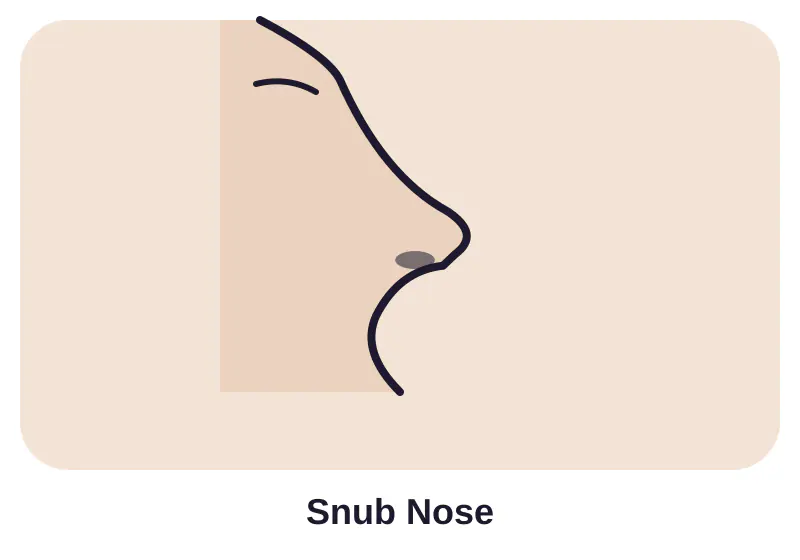 Illustration of snub nose